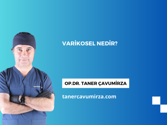 Varikosel Nedir?